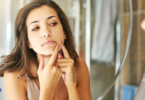 Overcoming acne: probiotics show promise - YINI